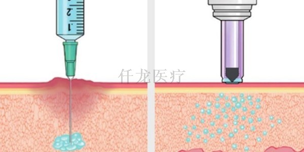 無針注射器應用在哪方面